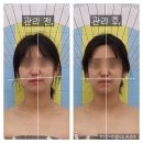 동안비결Beauty | [평택경락]두골비비대칭관리_평택세교동피부관리_"동안비결뷰티" 솔직후기