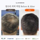 와이앤제이학원 | 두피문신 학원 초보도 실패없이 제대로 배우는 교육 후기