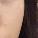 르미엘성형외과의원 이미지