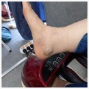 비고르바른건강핫톡 | 구미가볼만한곳 비고르바른건강 구미점 고주파발체온기로 몸의 온도 올리기