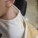 경상대학교병원 | 창원경상대학교병원 11개월 아기 CT 시티 촬영 검사 방법과 금식 비용