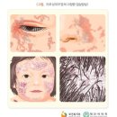 온기담은한의원 네이버블로그
