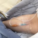 다시구월서연점 | 서연아이시험관 솔직 후기|난자2차 채취 20개 중 3개 동결|통증|복수|알부민 주사