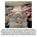 C 2 ganglion 압박으로 발생하는 경추성 두통 이미지