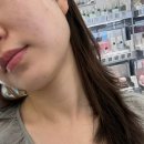 (주)천호엔케어 천호리테일 | [천호] 얼굴라인 정리되는 강동구피부관리가인미가 천호길동역점 윤곽관리 후기
