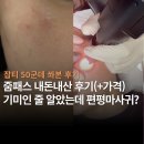 50 | 줌패스 잡티 50개 내돈내산 후기 | 기미인 줄 알았는데 편평사마귀? (+가격, 통증, 프로스팅)