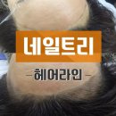네일트리 이미지