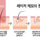 아띠의원 네이버블로그
