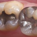 찬치과기공소 이미지