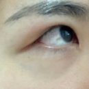 유망안과 네이버블로그