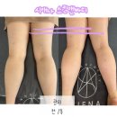 부토니끄 | 부산 영도 피부관리 시애나 스킨앤바디 탈라 냉동요법 다이어트 후기