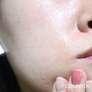 비타케어 이미지