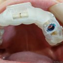 굿모닝치과기공소 이미지