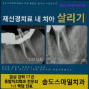 스마일디지털치과의원 | {인천,송도,잘하는,치과,추천!!} 송도스마일치과의원 인천 송도, 치과 공포증 환자 맞춤 치료