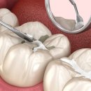 서울오브치과병원 이미지