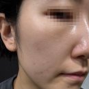 909뷰티 | 흑자 사라지는 곳 뷔에르뷰티 내돈내산 솔직후기