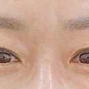 미쁨래쉬