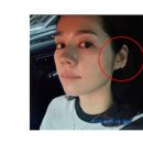 귀건강(이혈테라피) 이미지