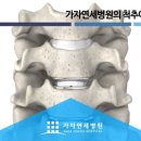 장기동정형외과 좁아진 척추, 해결방법은? 이미지