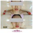 미소스킨바디 이미지