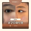 (주)피코 | 구로피부과 트러블 피부도 만족한 피코토닝 내돈내산 후기