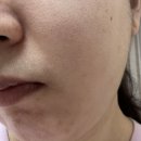 모공수축 멜리언스 진동클렌저 (내돈내산)