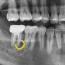 닥터굿플란트치과의원 이미지