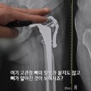 휴먼 메디칼 이미지