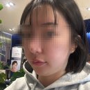 부산 성재영피부과에서 올타이트 리프팅 솔직 후기