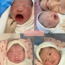 베드로의원 | 제왕절개 후기 하반신마취 회복 통증 운동 1일차 2일차