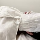 황금동 여드름 흉터 관리 글로리유에스테틱 알라딘 필링 내돈내산 후기