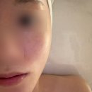 세븐테라피 | 청담피부관리 엘바이세븐 수분탄력 물방울관리 후기