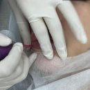 하단동1096 | 부산사하구 하단동 동아대 근처 입술틴트 자연스럽게 잘하는 곳 : 더고운뷰티(통증/후기/주의사항 등)