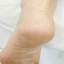 잠실역 | 잠실발관리 고민 끝! 엄마 발각질 싹 정리된 레푸스 잠실역점 후기