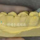 이다운치과기공소 네이버블로그