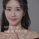 하안검수술 개념과 효과 그리고 비용 및 회복기간 알아보기 이미지