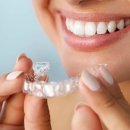 정영호치과의원 | 홍대교정치과, 부분교정이 가능한 케이스?