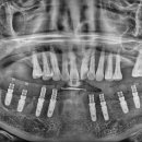서산치과기공소 이미지