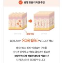 맘스외과성형외과의원 | 압구정성형외과 엔디어트 의원 🌟올리디아볼륨🌟 찐 후기