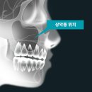 서울 훈 치과의원 이미지