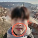 롱텀 | 남자 수염 레이져 제모 젠틀 맥스 플러스 아포지 플러스 롱텀 내돈내산 솔직후기