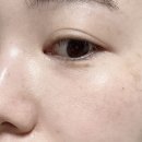 강화쌀 | 눈가아이패치 추천, 땡큐파머 강화 교동쌀 맑음 젤리 아이패치 사용 후기