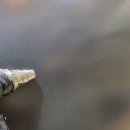 안산덴트
