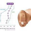 고려보청기(독일지멘스) 이미지