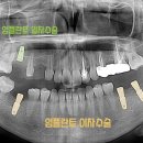 달서구청 우측 네이버블로그