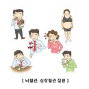 대사증후군 이미지