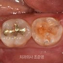 우리웰치과의원 | 우리웰치과 환자분들에게 전하고 싶은 진료 이야기