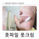 고운손병원 | 발뒷꿈치 발바닥 각질제거 유리 글라스 풋파일 굳은살 크림 추천 고운발 풋크림