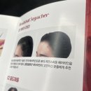 헤드샷스칼프SMP부산 이미지