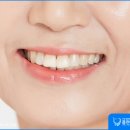 강남더밝은치과의원 이미지